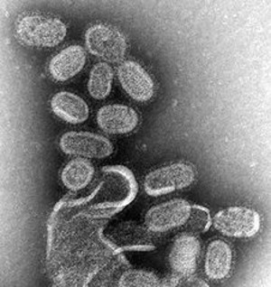 226pxem_of_influenza_virus